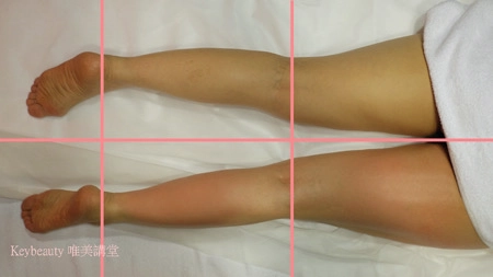 妳會發現，有經過調教的纖腿，就是不一樣。(上圖的左腿是沒有做過輕盈纖纖腿的情況；右腳是做過的樣子) 這可是水水與我們一起努力後的成果呢～