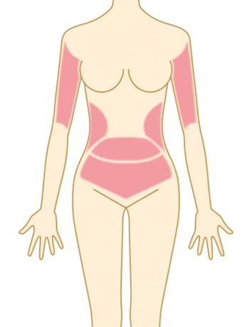 炎熱的夏季,露出身材穿上漂亮衣服是每個女孩的夢想。但手臂、腰、小腹上的小肚腩總是令人困擾。別擔心,讓KB極效爆脂幫你消除煩惱,讓你穿上短版上衣、比基尼,展現美麗曲線,並且放心享受海邊的陽光和海風。立刻預約KB極效爆脂,展現最美的自己!